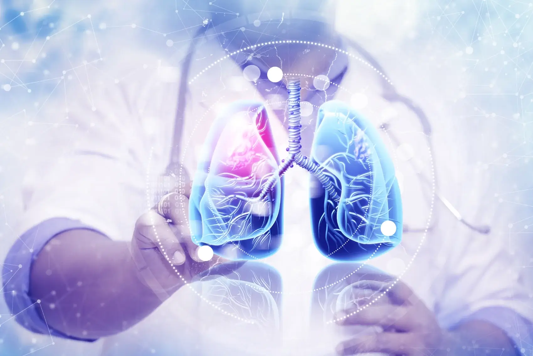 Lungenkrebsscreening